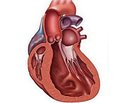 Диференційований пошук захворювання у пацієнта з гіпертиреозом при превалюючому синдромі серцево-судинних порушень. Клінічний випадок