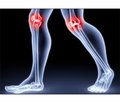 Application of Natural Factors for Prophylaxis and Treatment of Patients with Osteoarthritis with Low Bone Density
