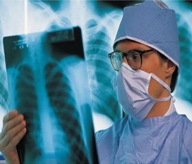 Гормональна активність щитоподібної залози залежно від клінічної форми туберкульозу легень 
