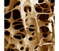 State of the Bone Tissue in the Premenopausal Women: the Frequency of  athology, Risk Factors