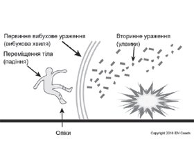 Наслідки дії вибухової хвилі на молодих киян (студентів): попередні дані