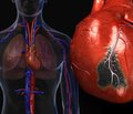Гострий коронарний синдром: догоспітальна реперфузійна терапія та кардіопротекція в клінічній практиці
