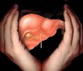Неалкогольна жирова хвороба печінки: поширеність, етіологія і патогенез, напрямки діагностики та терапії (огляд літератури та власні дані)