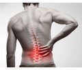 Manifestation of pain syndrome in lumbar instability