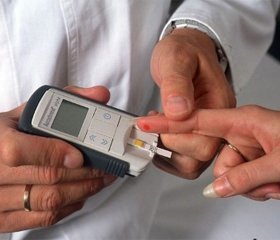 Цукровий діабет: діагностичні критерії, етіологія і патогенез