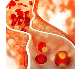 Лікування гіперліпідемії та інших метаболічних порушень біоактивними препаратами бергамоту і фолатів