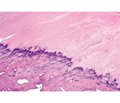 Histological features of metatarsophalangeal plantar plate structure