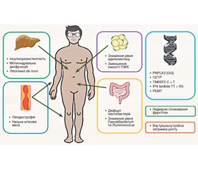 Неалкогольна жирова хвороба печінки в осіб з нормальною вагою: сучасні уявлення та підходи (огляд літератури)