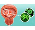 Рецидивуючі інфекції сечової системи: доказова база й дискутабельні питання заходів неантибактеріальної профілактики
