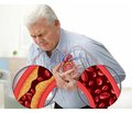 Сучасний погляд на патофізіологічні аспекти розвитку хронічної серцевої недостатності на тлі ішемічної хвороби серця