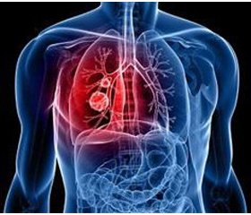 Влияние селена на функцию щитовидной железы и эффективность химиотерапии у больных туберкулезом с сопутствующим сахарным диабетом и аутоиммунным тиреоидитом