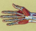 Лікування застарілих ушкоджень сухожилків розгиначів пальців кисті на рівні дистального міжфалангового суглоба