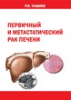 Первичный и метастатический рак печени 